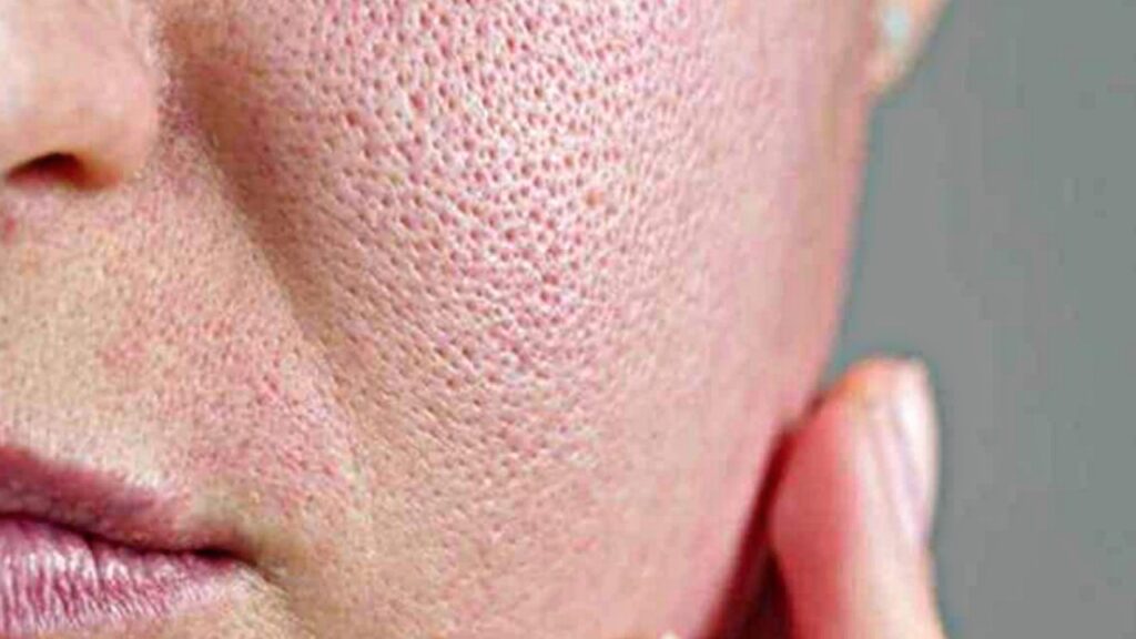 Open Pours Tips Open Pours Tips