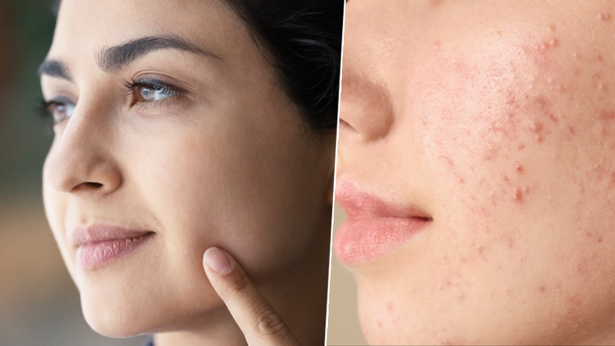 Nighttime Skin Care Routine for Oily Skin