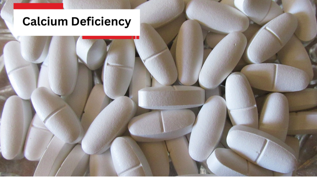 Calcium Deficiency Calcium Deficiency