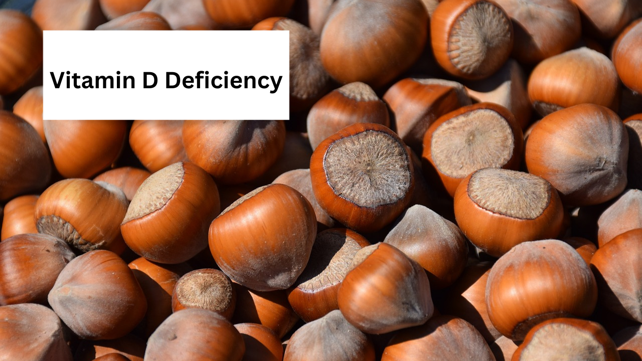 Vitamin D Deficiency Vitamin D Deficiency