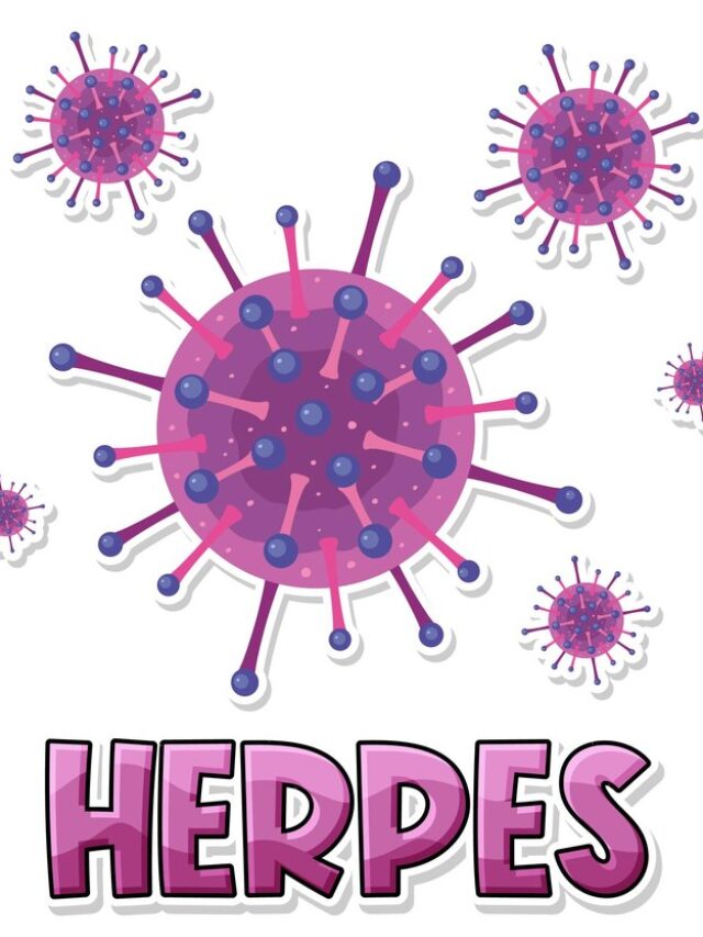 SYMPTOMS OF HERPES