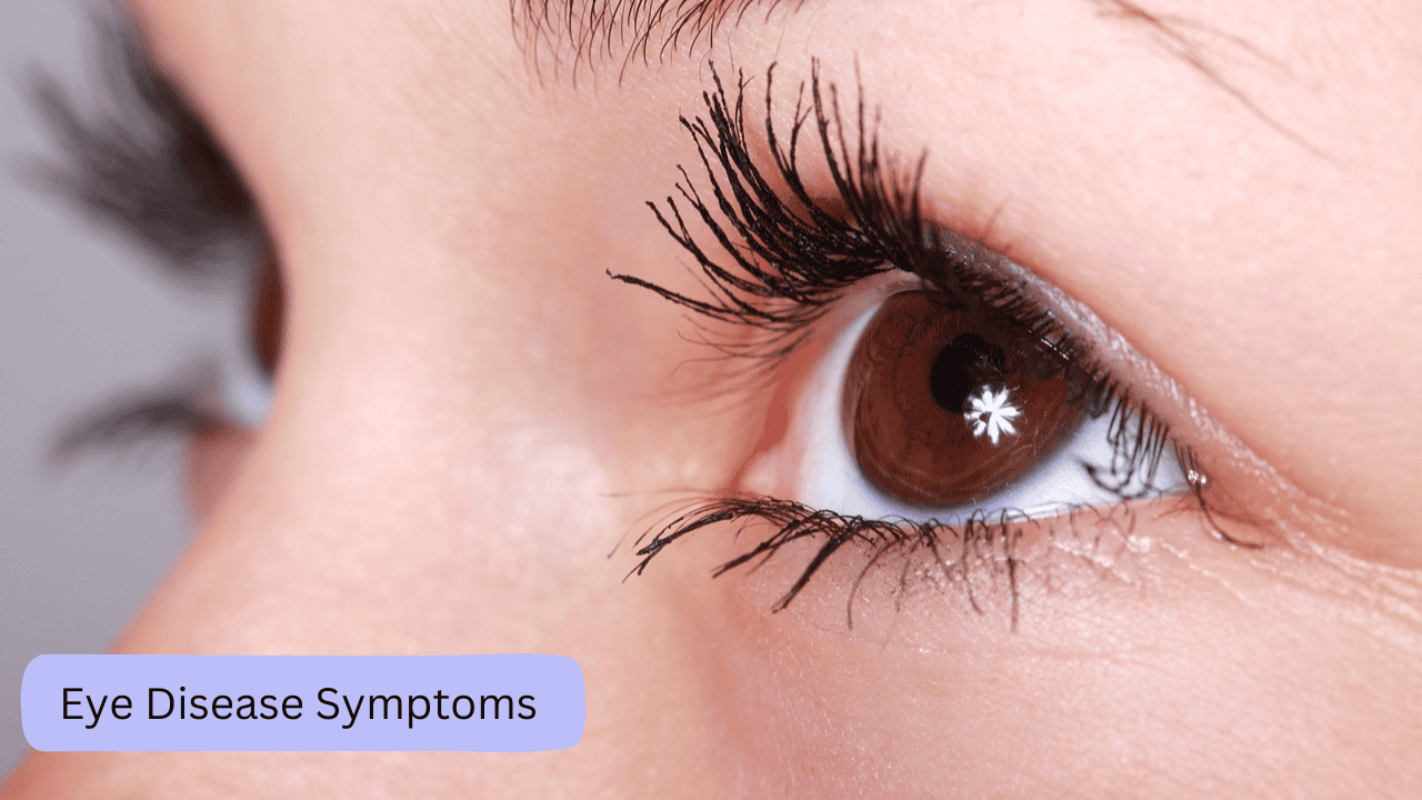 Eye Disease Symptoms