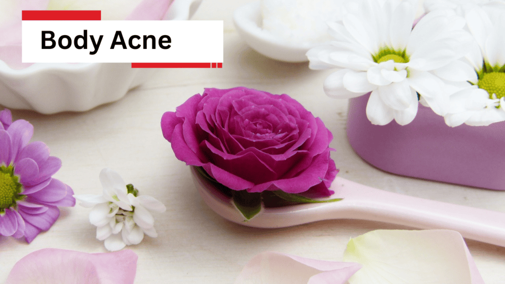 Body Acne
