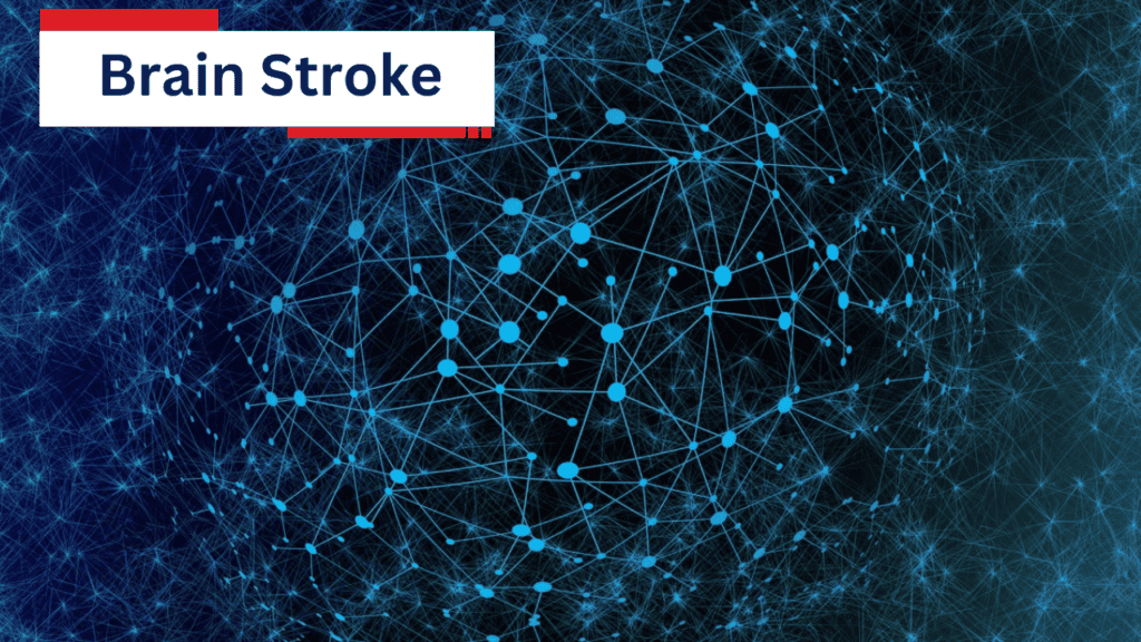 Brain Stroke