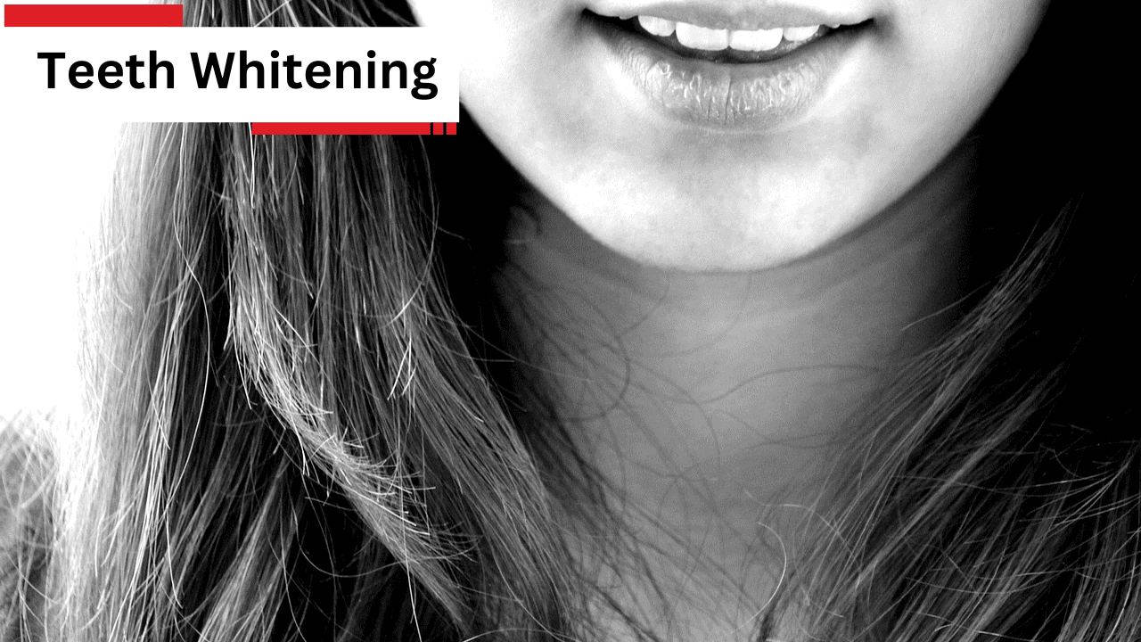Teeth Whitening