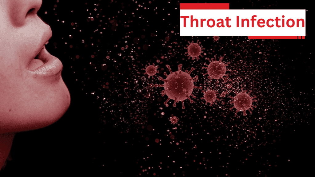 Throat Infection Throat Infection
