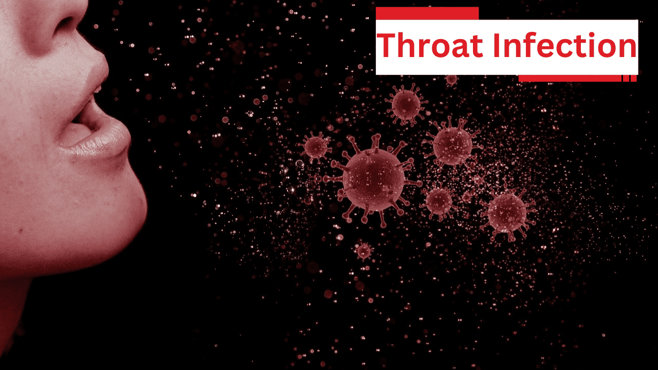 Throat Infection