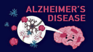 Alzheimer रोग के उपचार में नई उम्मीद: भारतीय वैज्ञानिकों ने विकसित किए नए अणु