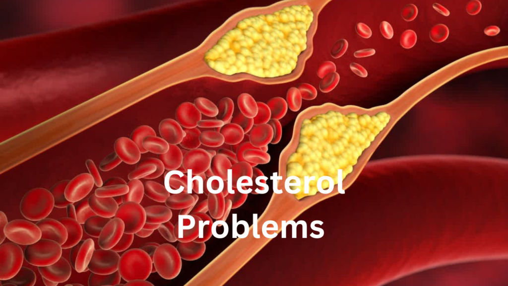 Cholesterol problems