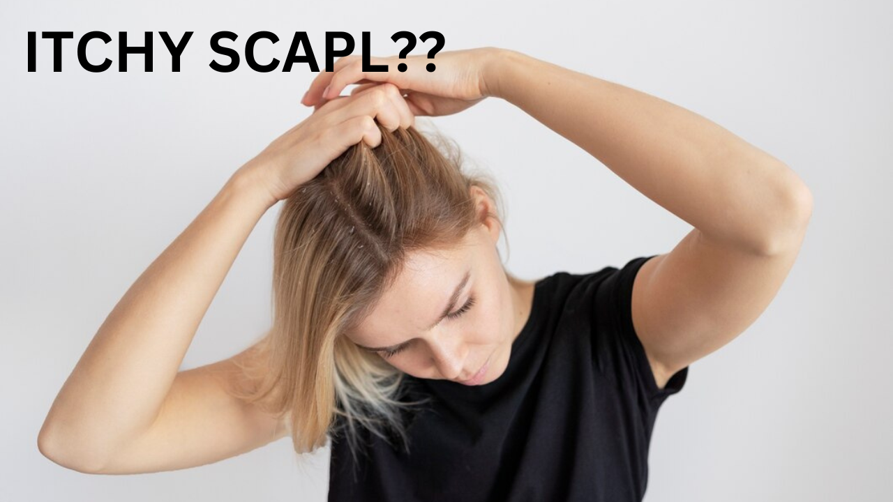 ITCHY SCALP 1