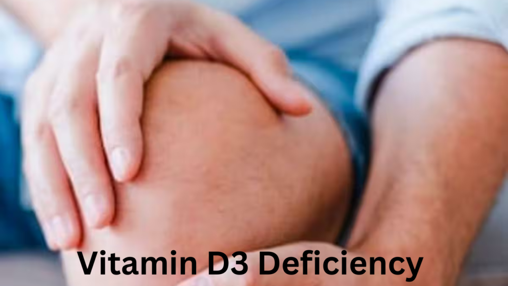VITAMIN D3 DEFICIENCY 1 VITAMIN D3 DEFICIENCY 1