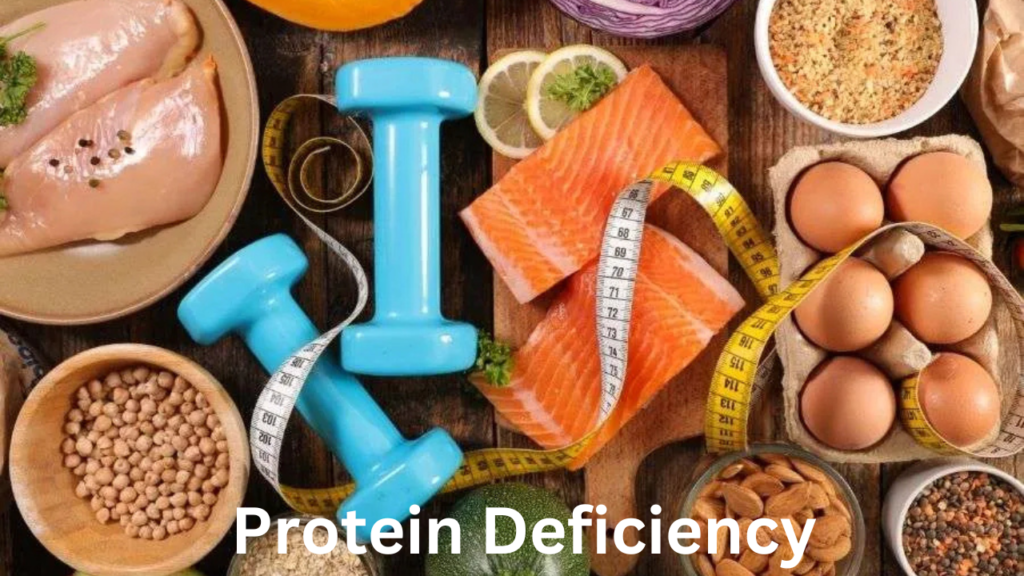 protein deficiency protein deficiency
