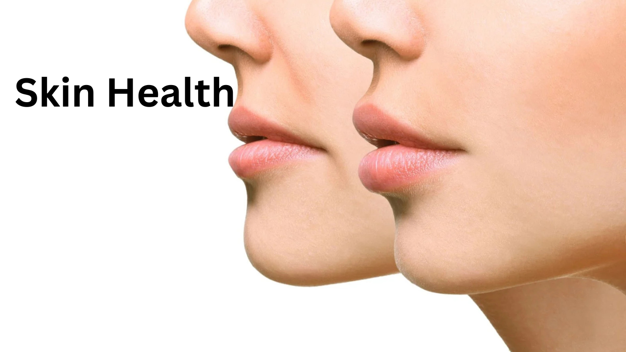 skin health 1