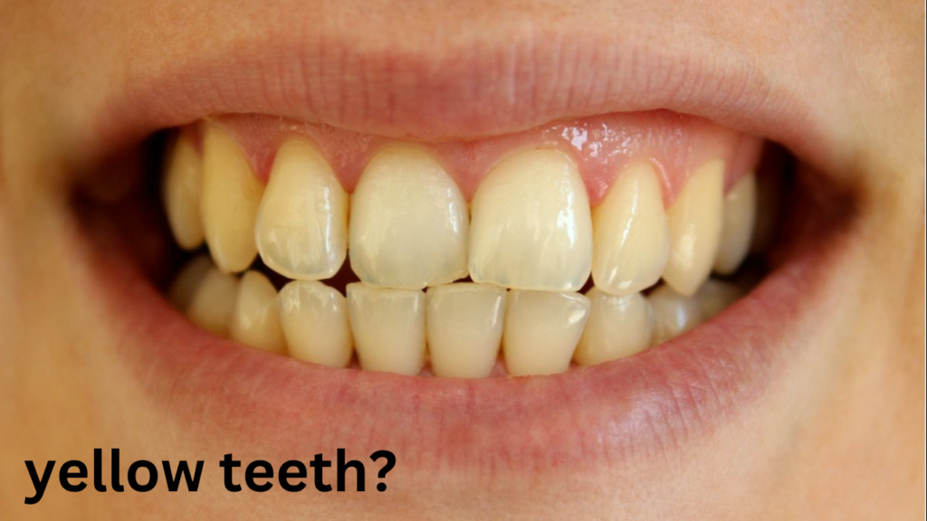 teethss teethss