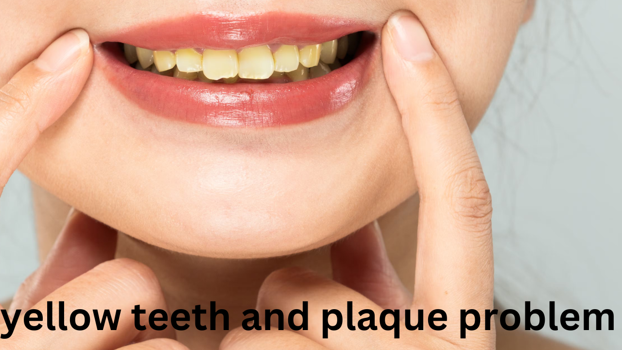 teethss 2
