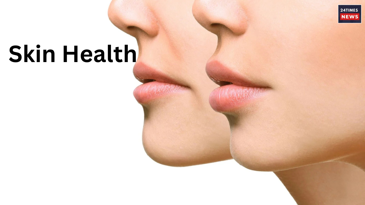 want a baby like skin 1