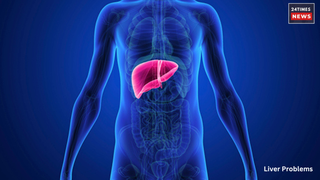 liver problems 4 liver problems 4