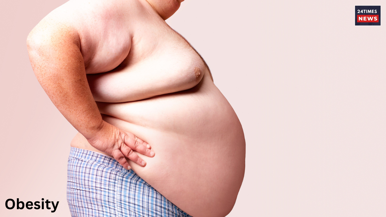 obesity and its consequences 1