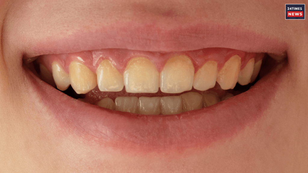 yellow teeth problems yellow teeth problems