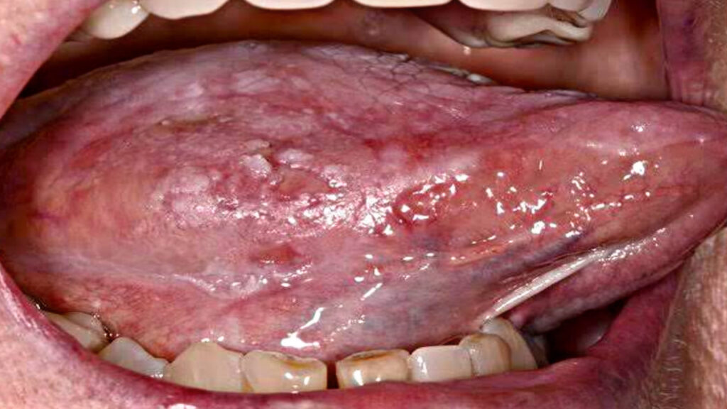 4673AAE9 4A76 4B1A 9741 912D161DB239 4673AAE9 4A76 4B1A 9741 912D161DB239