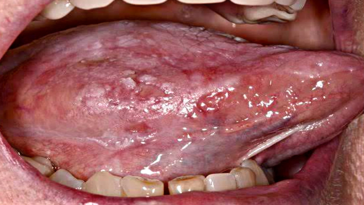 4673AAE9 4A76 4B1A 9741 912D161DB239