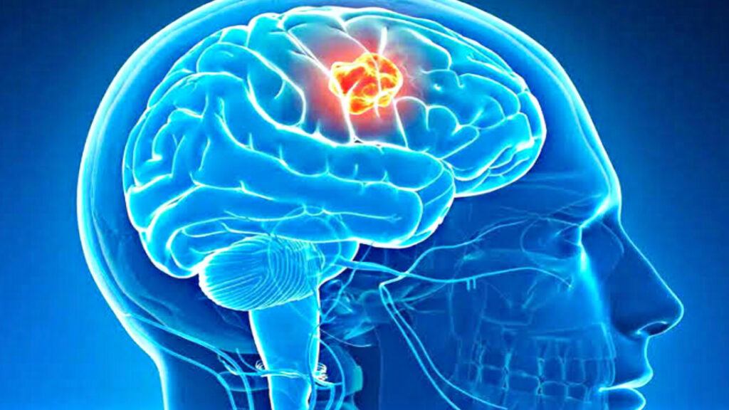 920904D6 C3F0 40F4 ACCF 43E0F92391BC 920904D6 C3F0 40F4 ACCF 43E0F92391BC