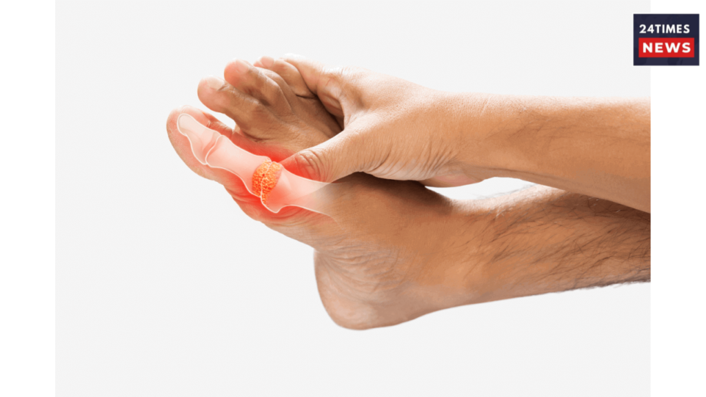 high uric acid 1 high uric acid 1