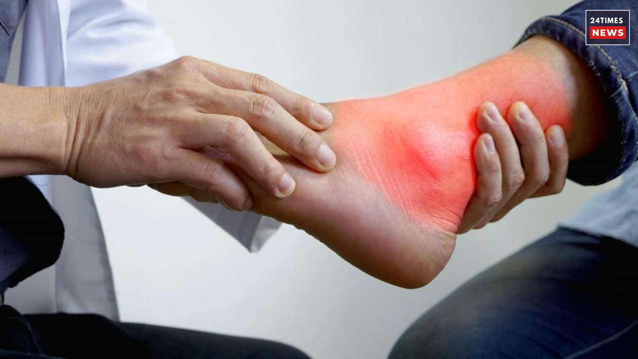 uric acid problems 1