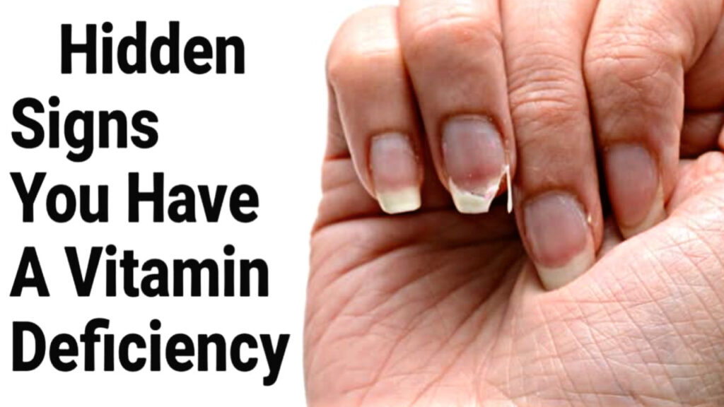 05B3C671 B6F8 4EA7 82BB 3E94E5408E48 05B3C671 B6F8 4EA7 82BB 3E94E5408E48