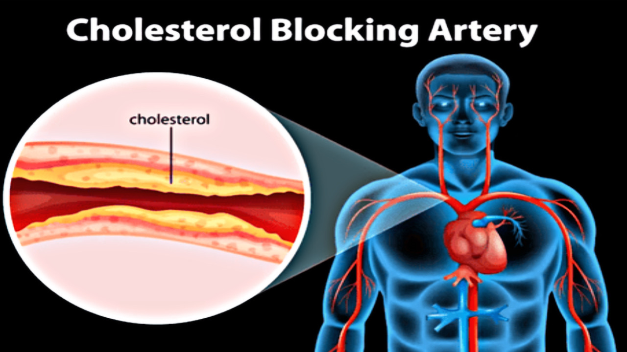 D993AF28 907D 409C 9AB7 B6B4544EDAD1