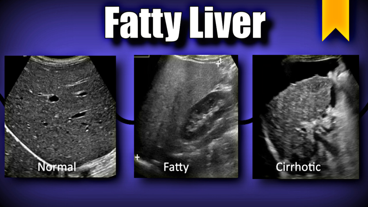 F128010B 8163 4622 98A1 F4186FBA22FD