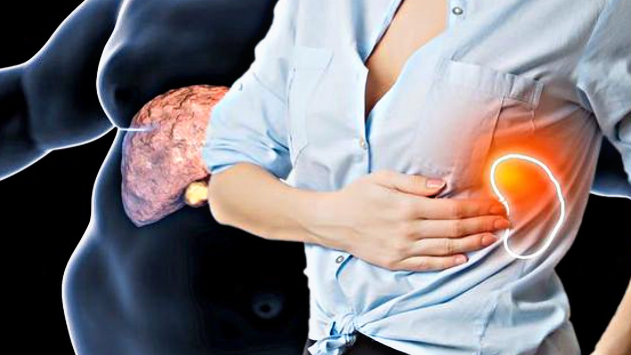 F3A2AAE0 9B2B 4E91 B15B A99BCF746D30