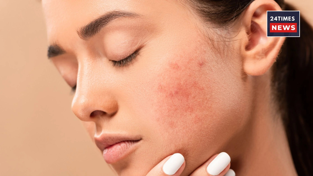 Untitled design 13 7 Untitled design 13 7