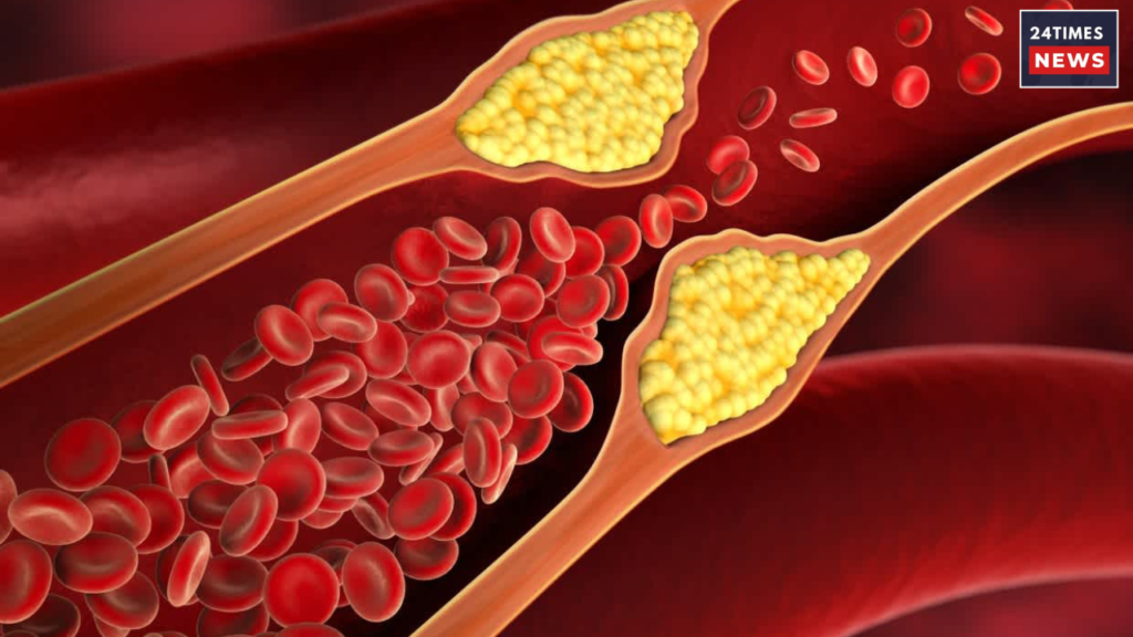 cholesterol problems and symptoms 1 cholesterol problems and symptoms 1