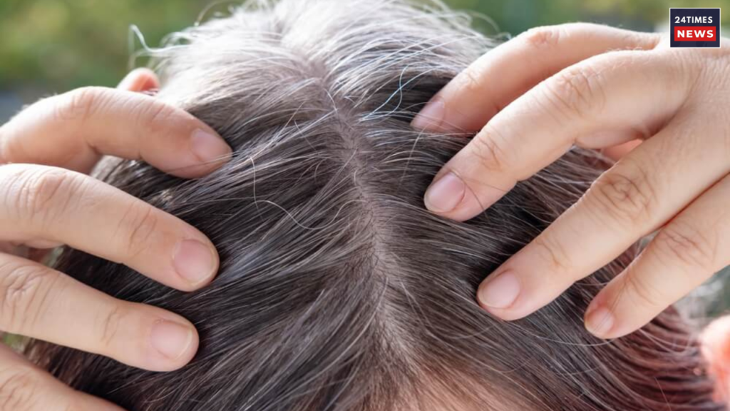 grey hair in kids grey hair in kids