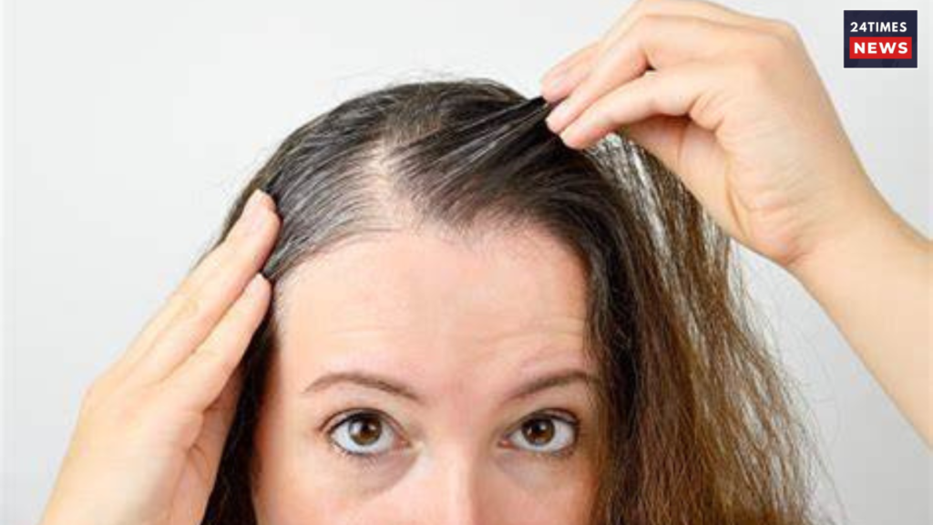 hair problems hair problems