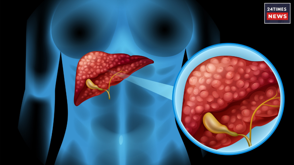 liver health and unhealthy food items 1 liver health and unhealthy food items 1