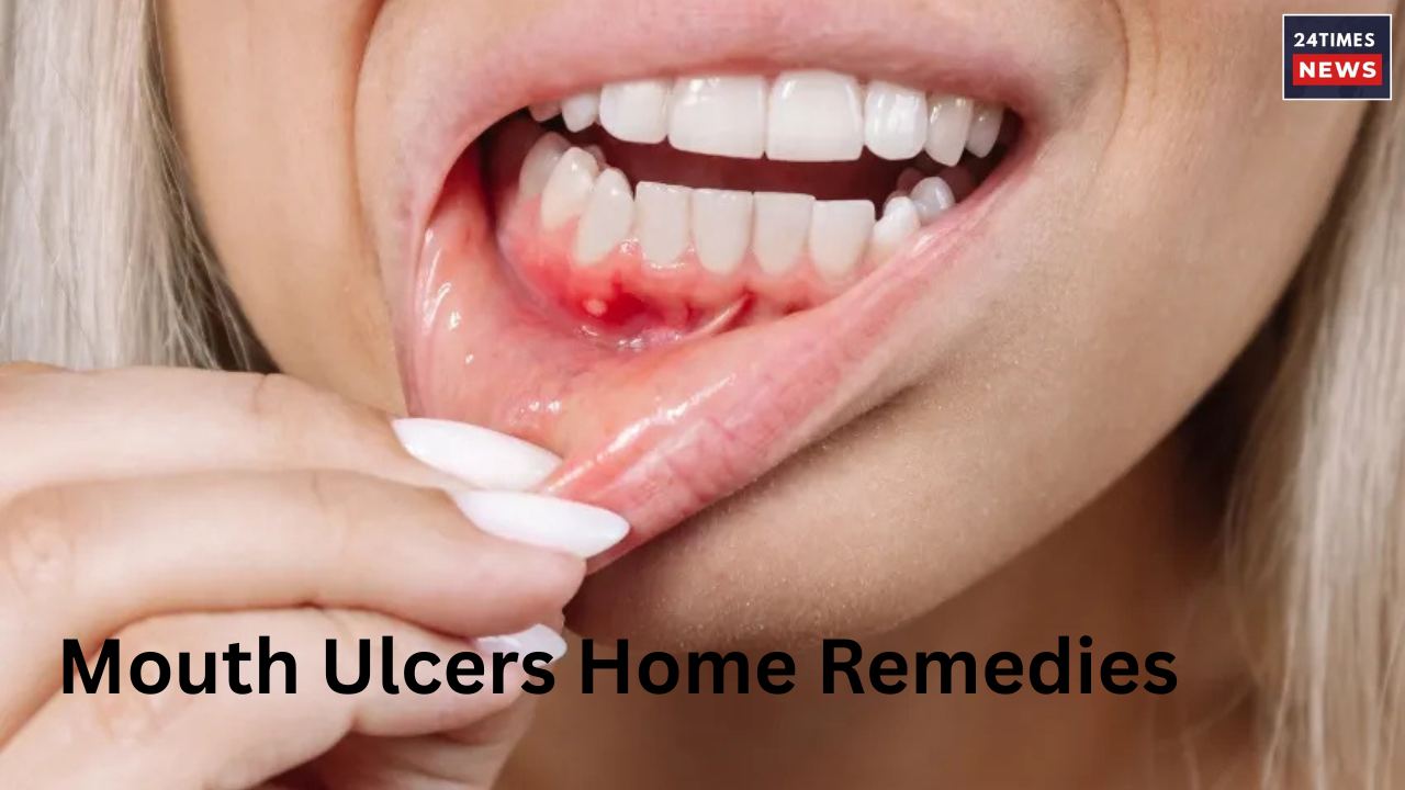 Mouth Ulcers Home Remedies