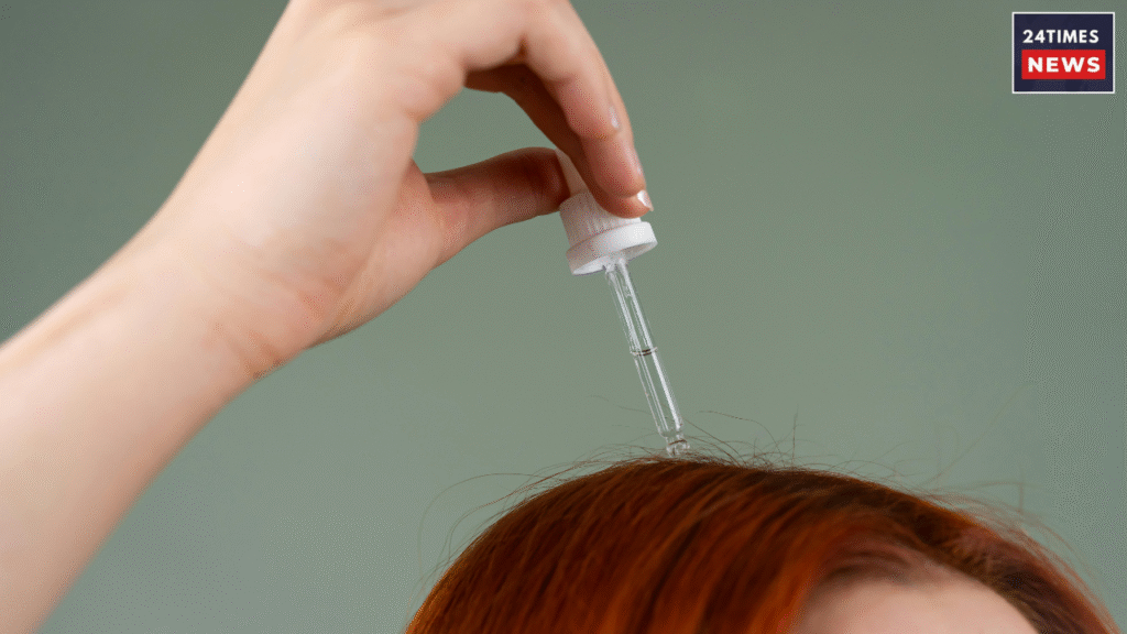 dandruff hair dandruff hair