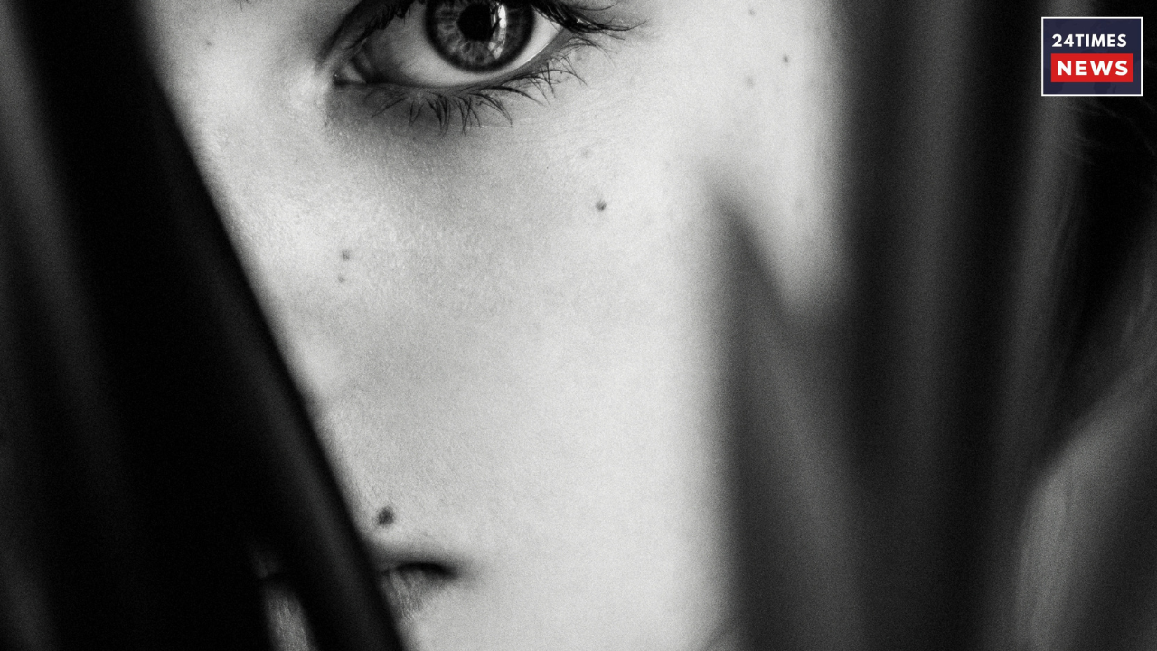 dark circles 1