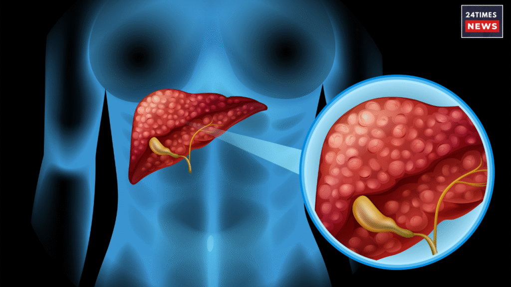 liver health liver health