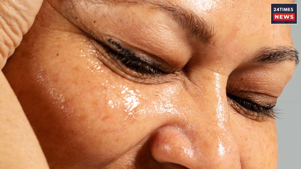 oily skin 1