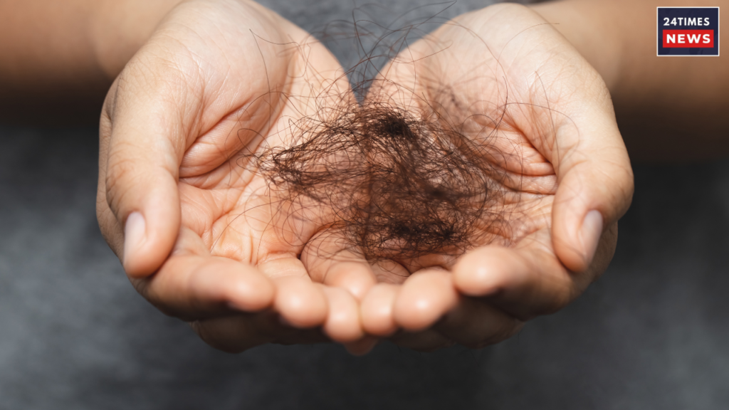 problems of hairfall problems of hairfall