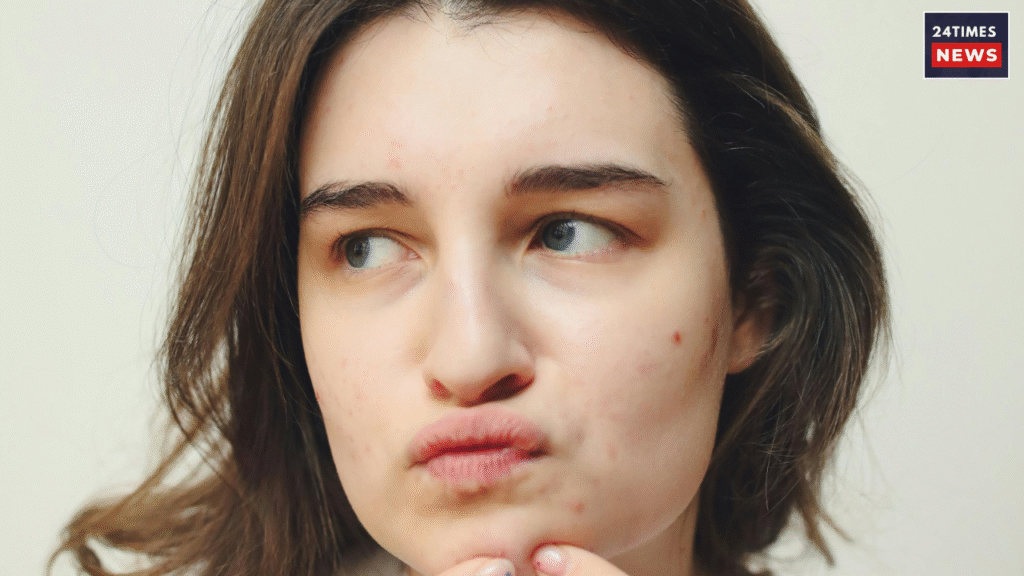 skin concerns 1 skin concerns 1