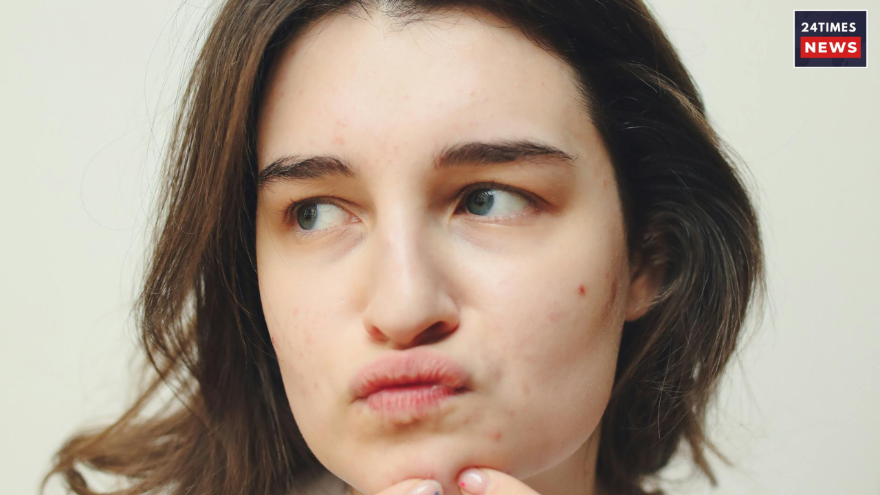 skin concerns 1
