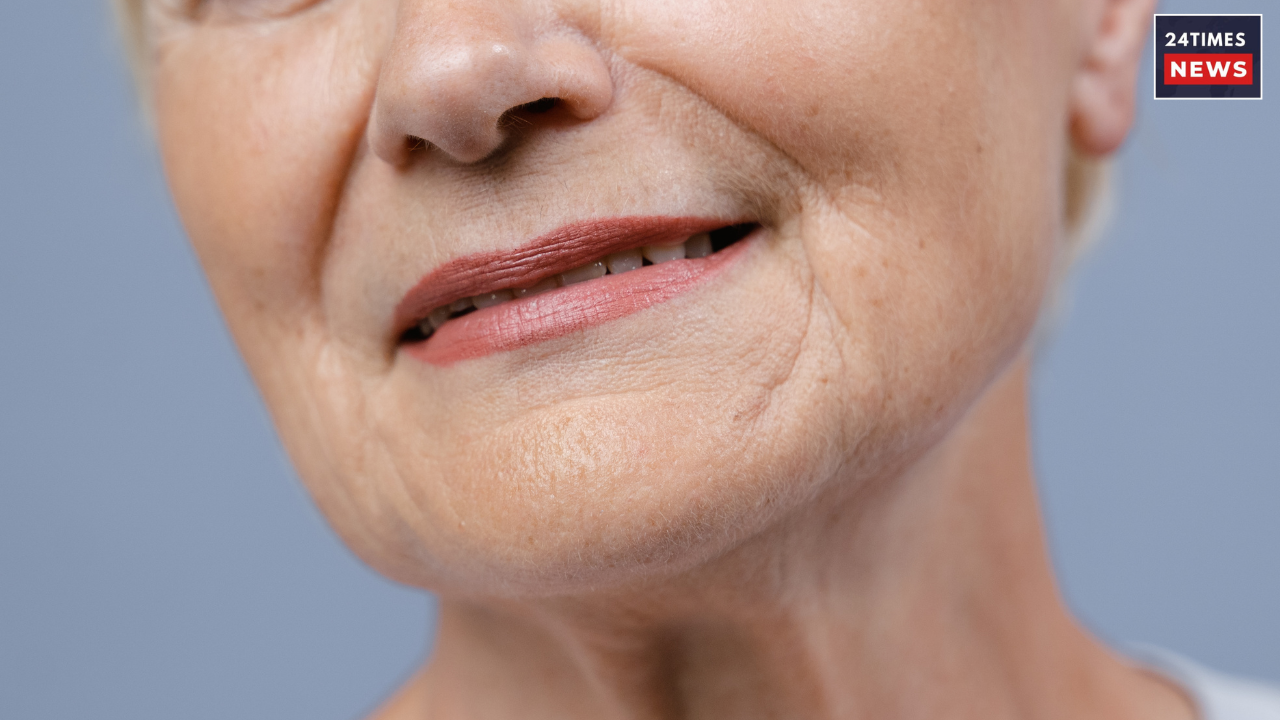 wrinkles and finelines 1