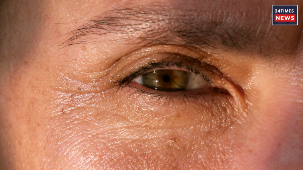 wrinkles and finelines wrinkles and finelines