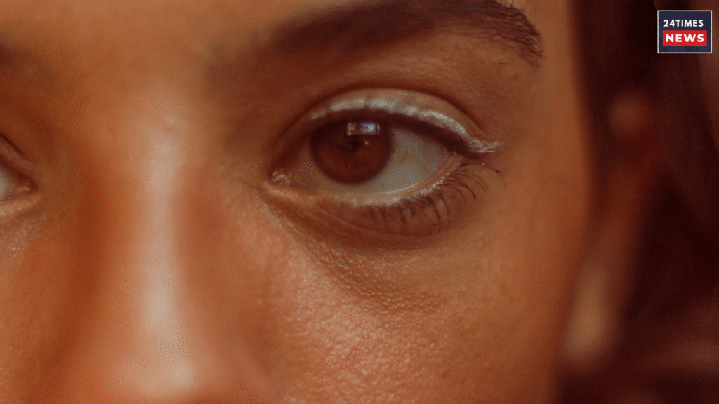 dark circles under eyes