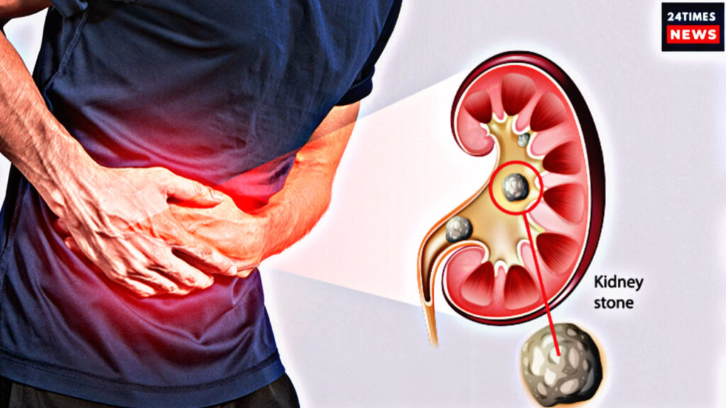 1538E2E5 41C9 4943 81A9 C10C66EFBD5A 1538E2E5 41C9 4943 81A9 C10C66EFBD5A