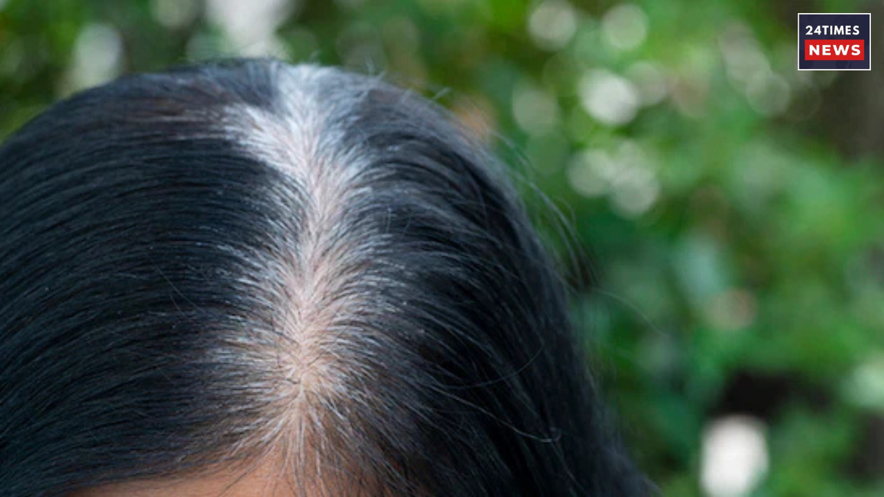 Untitled design 2025 11 15T182115.506